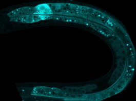 Organismo modelo ‘C. elegans’ visto al microscopio. / CSIC.