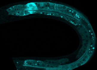 Organismo modelo ‘C. elegans’ visto al microscopio. / CSIC.