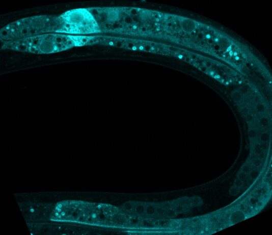 Organismo modelo ‘C. elegans’ visto al microscopio. / CSIC.