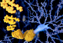 Un análisis de sangre podría transformar el diagnóstico temprano del Alzheimer