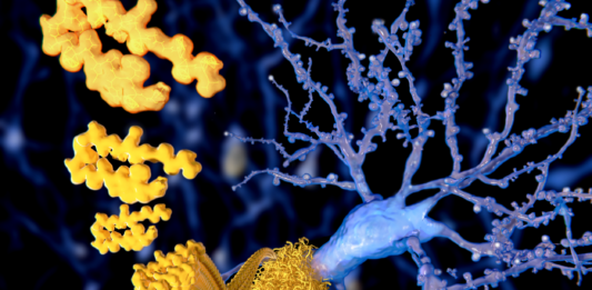 Un análisis de sangre podría transformar el diagnóstico temprano del Alzheimer