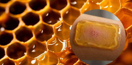Miel de Ulmo chilena inspira parche inteligente para regenerar heridas